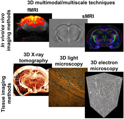 Multiscale Imaging Approach for Studying the Central Nervous System: Methodology and Perspective